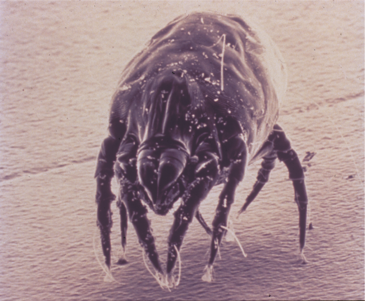 dustmite